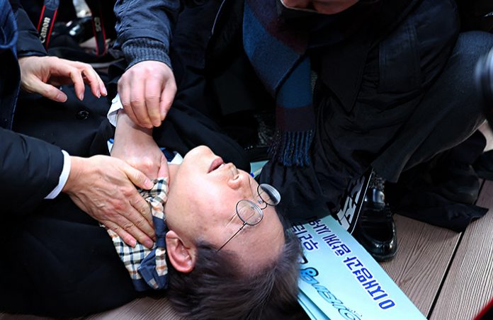 В Южной Корее лидер оппозиции получил ножевой удар в шею