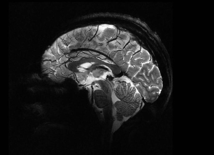Самый мощный в мире магнитно-резонансный томограф делает первые снимки | New-Science.ru